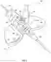 Fig. 06 - Soft push tabs for catheter adapter