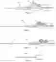 Fig. 05 - Catheter placement device