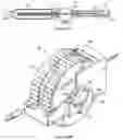 Fig. 06 - Catheter placement device