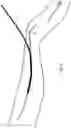 Fig. 09 - Method and device for sheathless arterial catheterization