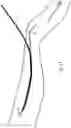 Fig. 13 - Method and device for sheathless arterial catheterization