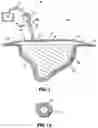 Fig. 02 - SELF CONTAINED WOUND DRESSING APPARATUS