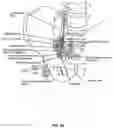 Fig. 04 - Implantable lead affixation structure for nerve stimulation to alleviate bladder dysfunction and other indication