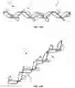 Fig. 15 - Implantable lead affixation structure for nerve stimulation to alleviate bladder dysfunction and other indication