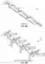 Fig. 18 - Implantable lead affixation structure for nerve stimulation to alleviate bladder dysfunction and other indication