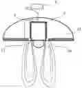 Fig. 01 - Device and method for neuromodulation treatment