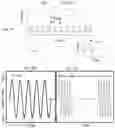 Fig. 03 - Devices and methods for electrical stimulation and their use for vagus nerve stimulation on the neck of a patient