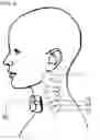 Fig. 09 - Devices and methods for electrical stimulation and their use for vagus nerve stimulation on the neck of a patient