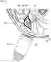 Fig. 10 - Devices and methods for electrical stimulation and their use for vagus nerve stimulation on the neck of a patient