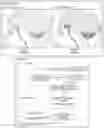 Fig. 01 - Method of neural intervention for the treatment of affective neuropsychiatric disorders