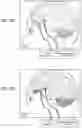Fig. 06 - Method of neural intervention for the treatment of affective neuropsychiatric disorders