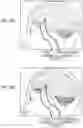 Fig. 07 - Method of neural intervention for the treatment of affective neuropsychiatric disorders