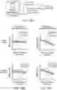 Fig. 34 - Method of neural intervention for the treatment of affective neuropsychiatric disorders