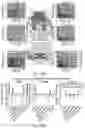Fig. 37 - Method of neural intervention for the treatment of affective neuropsychiatric disorders
