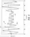 Fig. 05 - Bilateral synchronized channel selection for cochlear implants