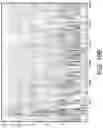 Fig. 13 - Bilateral synchronized channel selection for cochlear implants