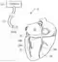 Fig. 01 - METHOD FOR STIMULATING HEART MUSCLE ACTIVITY DURING THE REFRACTORY PERIOD