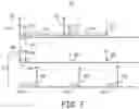 Fig. 08 - Multi-chamber intracardiac pacing system