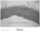 Fig. 11 - RADIOFREQUENCY BALLOON CATHETER SYSTEM
