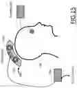 Fig. 11 - Adaptive magnetic stimulation therapy