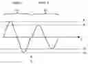 Fig. 01 - Bi-phasic paired pulse transcranial magnetic stimulation