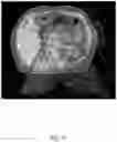 Fig. 11 - Systems and methods for quality control in image-guided radiotherapy