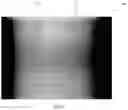 Fig. 06 - Imagers in radiation therapy environment
