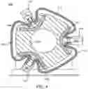 Fig. 05 - Systems and methods for linear accelerator radiotherapy with magnetic resonance imaging