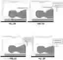 Fig. 03 - Method of markerless measurement and calculation for personalized and reproducible breath holds for radiation therapy and medical imaging