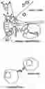 Fig. 01 - Device for treating malignant diseases with the help of tumor-destructive mechanical pulses (TMI)