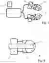 Fig. 02 - Device for treating malignant diseases with the help of tumor-destructive mechanical pulses (TMI)
