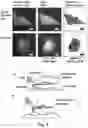 Fig. 04 - Device for treating malignant diseases with the help of tumor-destructive mechanical pulses (TMI)