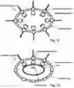 Fig. 11 - Device for treating malignant diseases with the help of tumor-destructive mechanical pulses (TMI)