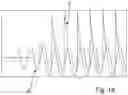 Fig. 13 - Device for treating malignant diseases with the help of tumor-destructive mechanical pulses (TMI)
