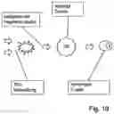 Fig. 15 - Device for treating malignant diseases with the help of tumor-destructive mechanical pulses (TMI)