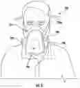 Fig. 04 - Respirator