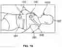 Fig. 11 - SYSTEM AND METHOD FOR OPTIMIZING DIAPHRAGMATIC BREATHING