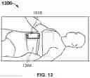 Fig. 14 - SYSTEM AND METHOD FOR OPTIMIZING DIAPHRAGMATIC BREATHING