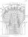 Fig. 01 - Pocket-channeling lacrosse head