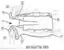 Fig. 01 - Low profile articulation jaw joint stabilizer device