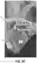 Fig. 05 - GEAR (GAME ENHANCING AUGMENTED REALITY): A LOWER LIMB ALTERNATIVE CONTROL INTERFACE FOR COMPUTERS