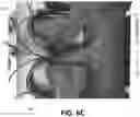 Fig. 11 - GEAR (GAME ENHANCING AUGMENTED REALITY): A LOWER LIMB ALTERNATIVE CONTROL INTERFACE FOR COMPUTERS