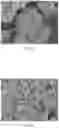 Fig. 03 - ZSM-35 molecular sieve and preparation method thereof