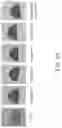 Fig. 11 - Polymer-Collagen Composite Film And Method Of Forming The Same