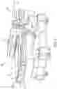 Fig. 03 - Laser Machining Systems and Methods with Vision Correction and/or Tracking