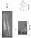 Fig. 06 - Reversible wrench rack
