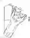 Fig. 09 - Surgical robotic arm admittance control