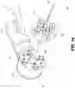Fig. 15 - Surgical robotic arm admittance control