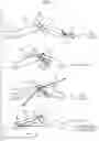 Fig. 05 - Force transmitting mechanism and instrument