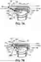 Fig. 11 - TRIMMING BLADE HEAD AND A RAZOR COMPRISING A RAZOR HANDLE AND SUCH A TRIMMING BLADE HEAD